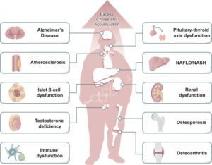 Cholesterol Disorders