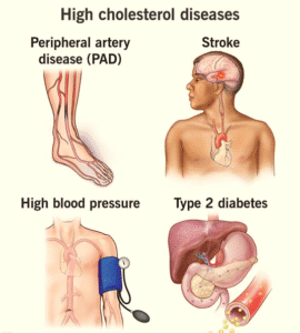 Cholesterol Disorders