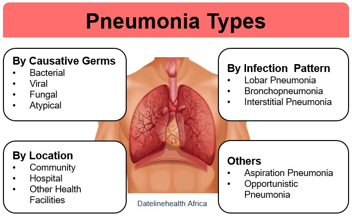 Pneumonia Symptoms and Treatment
