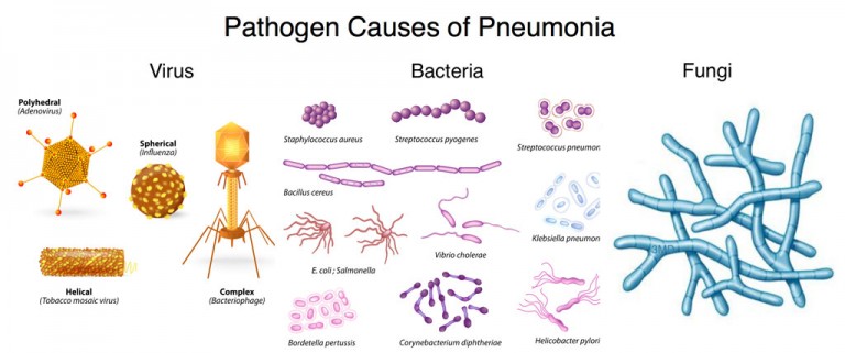 Pneumonia Symptoms and Treatment