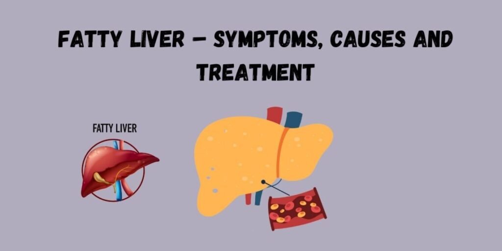 Fatty Liver Disease Symptoms and Treatment guide explaining causes, stages, diagnosis, and liver health management