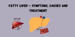 Fatty Liver Disease Symptoms and Treatment guide explaining causes, stages, diagnosis, and liver health management