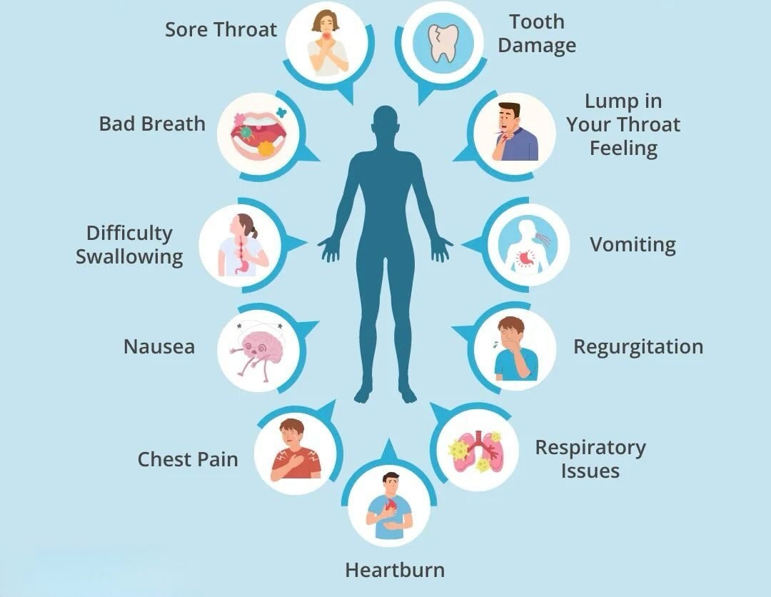 GERD Symptoms and Treatment guide explaining acid reflux causes, diagnosis, treatment, and prevention