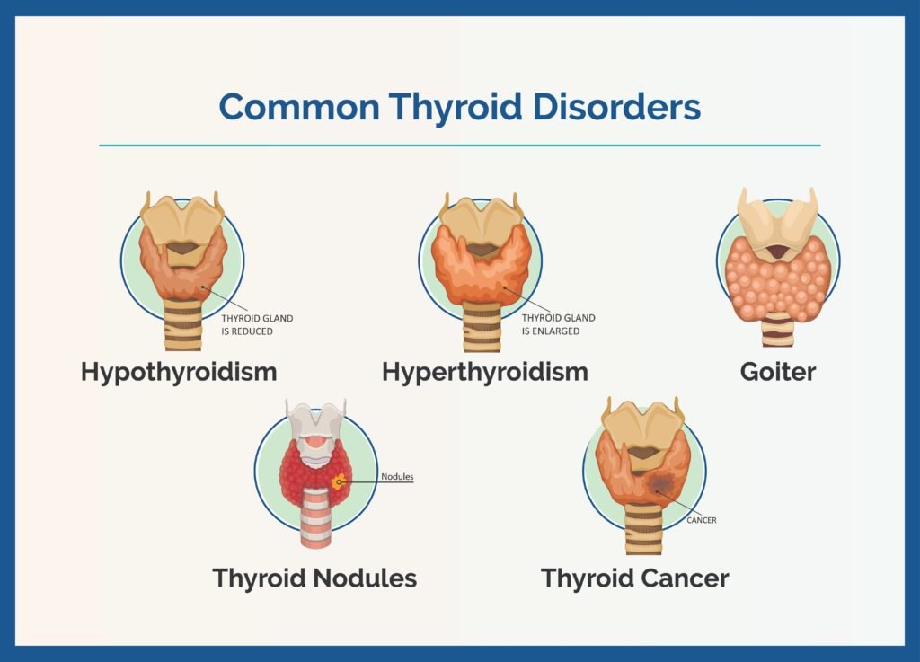 Thyroid Disorders Symptoms and Treatment guide comparing hypothyroidism and hyperthyroidism