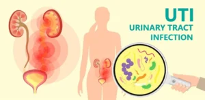 UTI Symptoms and Treatment guide explaining causes, diagnosis, treatment, and prevention of urinary tract infections