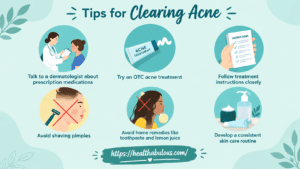 Acne During Pregnancy